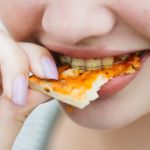 Summer Snacking with Braces: Healthy Choices for Patients with Braces