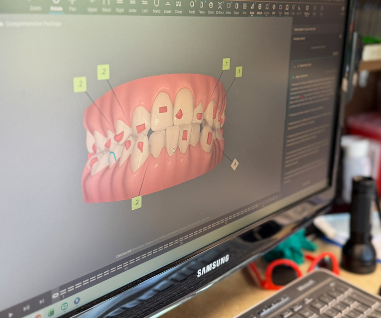 Digital imaging evaluation for Braces