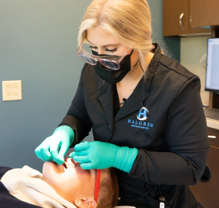 Invisalign First | Halgren Orthodontics at Mt Vernon & Orcas Island WA