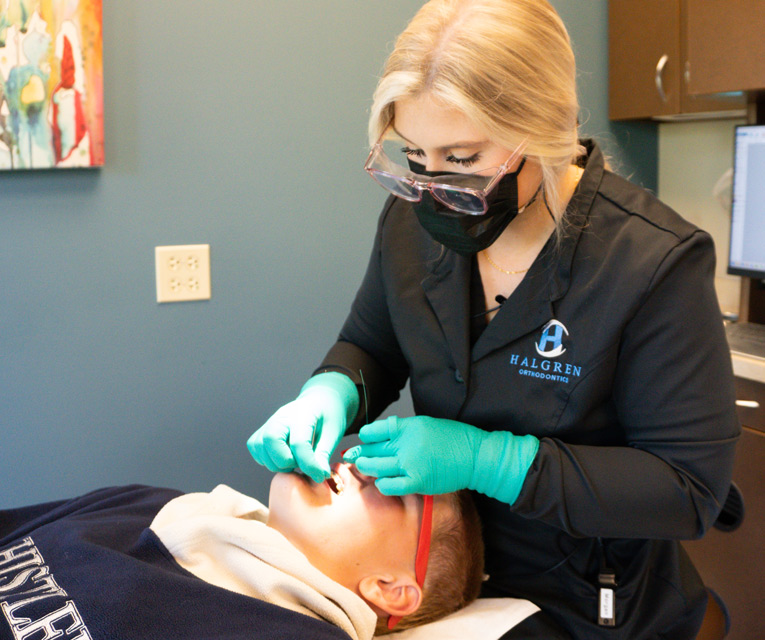 Invisalign Teen | Halgren Orthodontics at Mt Vernon & Orcas Island WA
