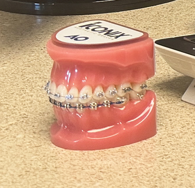 Braces for Teens | Halgren Orthodontics