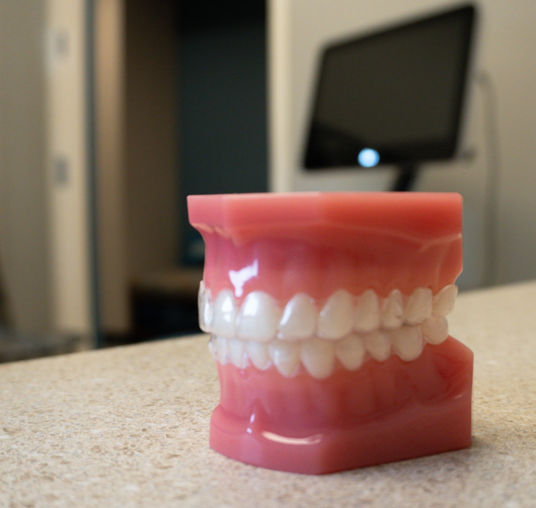Invisalign for adults - Halgren Orthodontics
